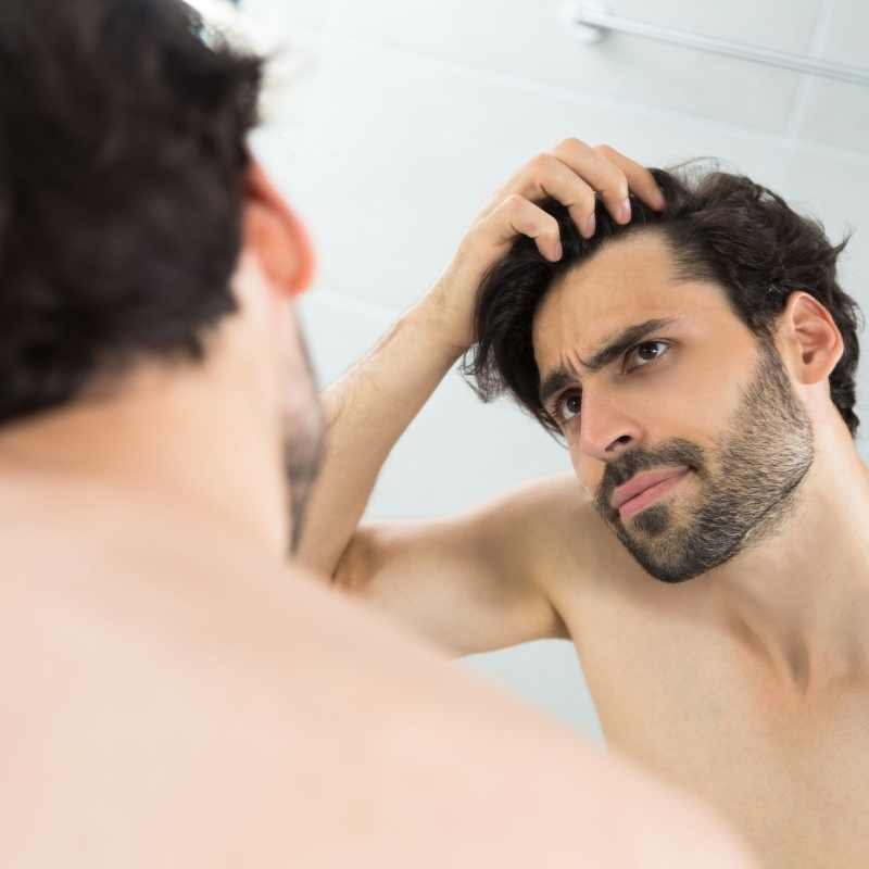 opadanje kose kod muškaraca lijek